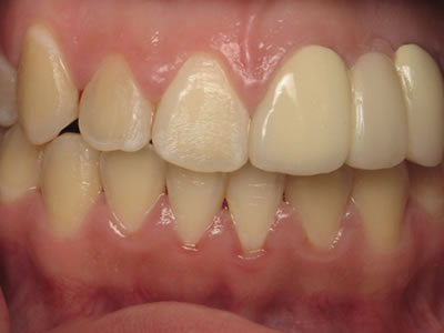 Odontología estética y reconstructiva Dentista Torreon coahuila Gomez palacio durango