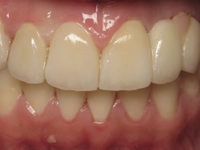 Odontología estética y reconstructiva Dentista Torreon coahuila Gomez palacio durango