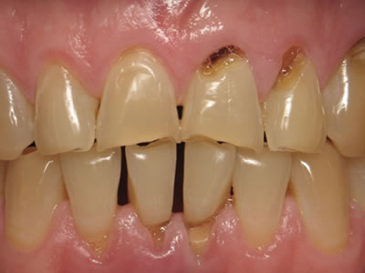 Odontología estética y reconstructiva Dentista Torreon coahuila Gomez palacio durango