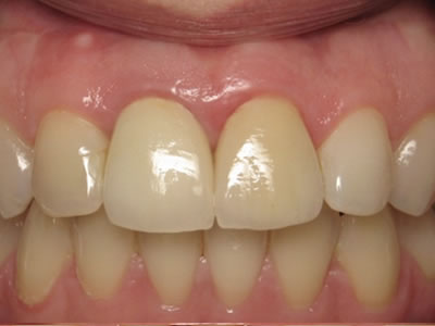 Odontología estética y reconstructiva Dentista Torreon coahuila Gomez palacio durango