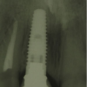 Odontología estética y reconstructiva Dentista Torreon coahuila Gomez palacio durango