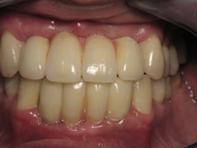 Odontología estética y reconstructiva Dentista Torreon coahuila Gomez palacio durango